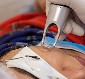 پزشکی و سلامت- لیزر درمانی